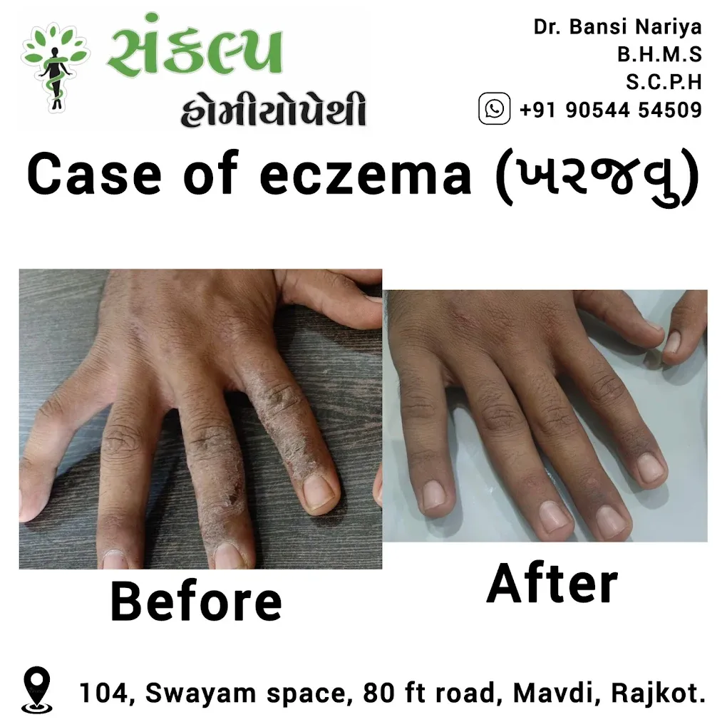 Sankalp Homoeopathy | Homeopathic Clinic