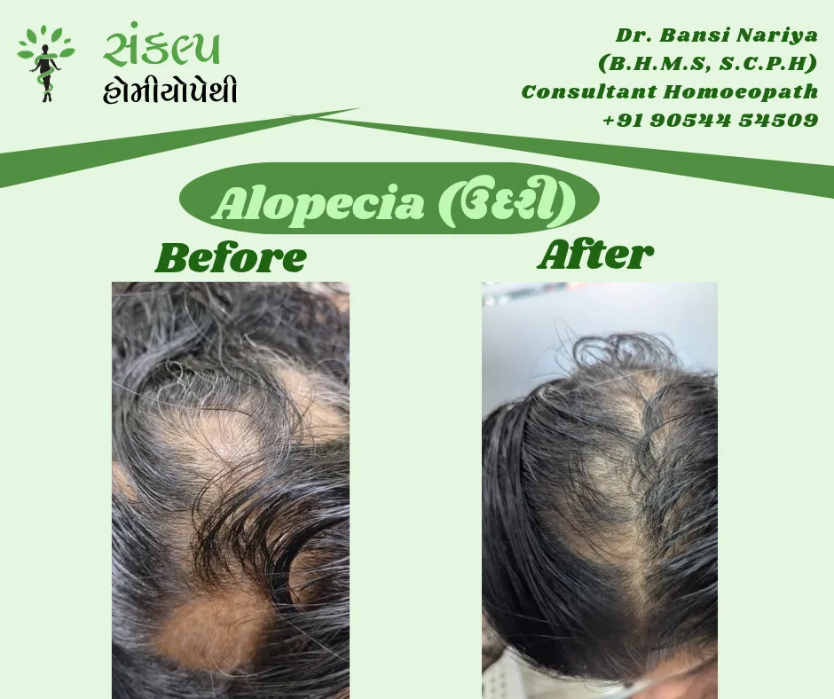 Sankalp Homoeopathy | Homeopathic Clinic